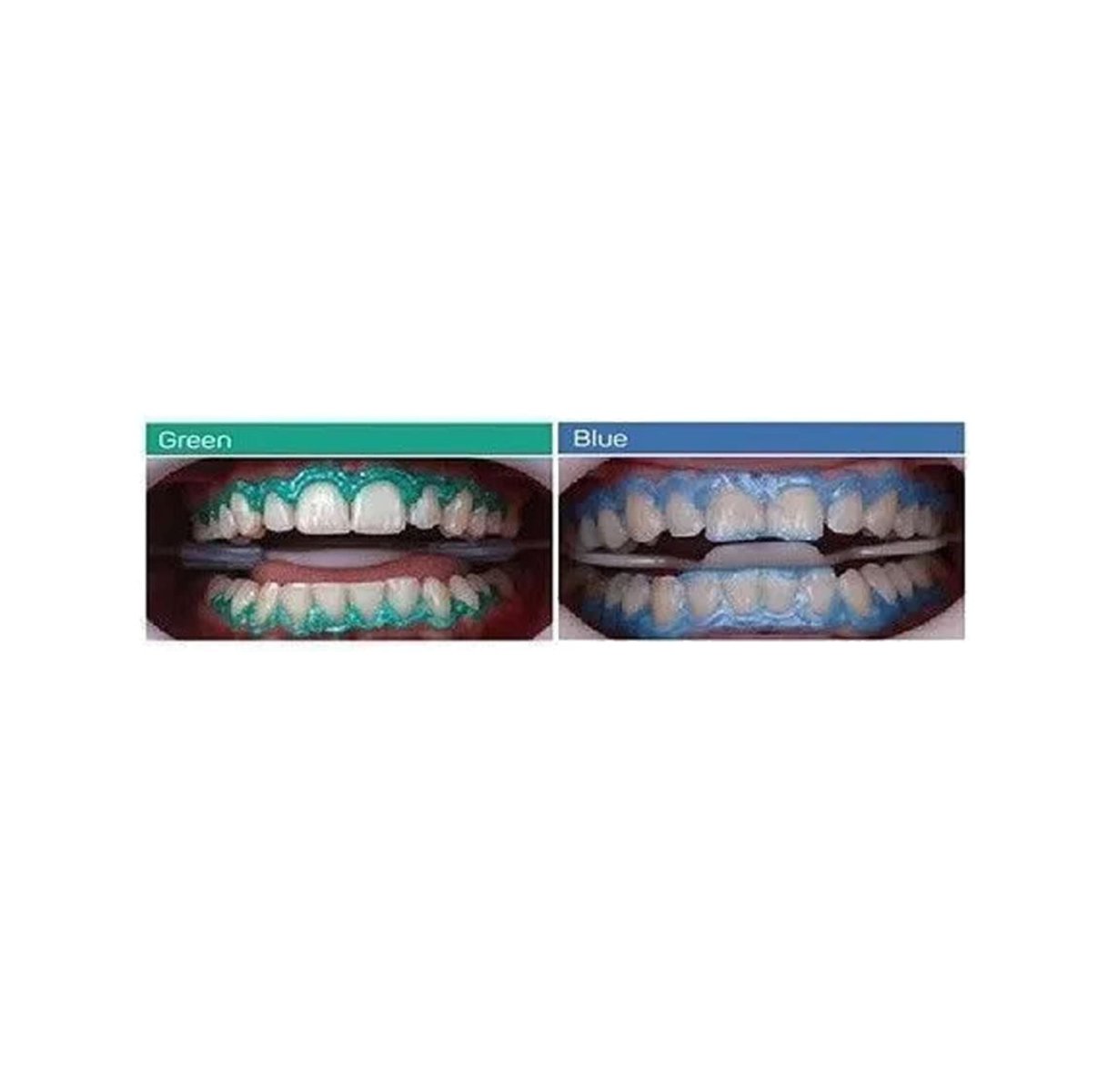 Top Dam Rubber dam 液體橡皮障 - 上宏牙材 Macro Dental