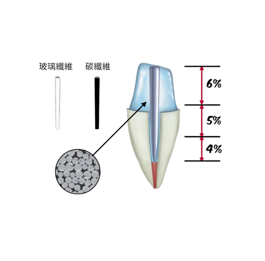 Conic 456 post玻璃纖維/碳纖維根管柱 (4-5-6%)