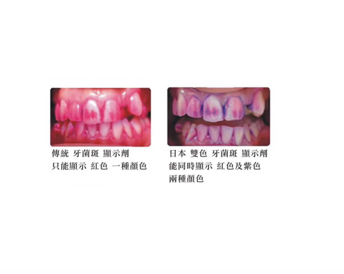 日本雙色牙菌斑顯示劑 - 上宏牙材 Macro Dental