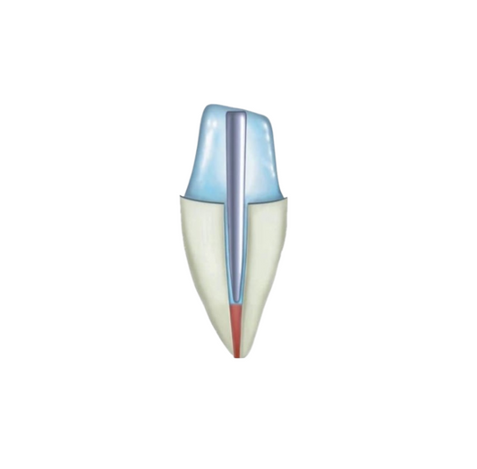 Conic 24 post玻璃纖維/碳纖維根管柱 (2-4%)